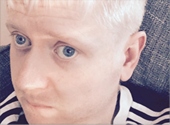 male with lazy eye and white blonde hair, looking shy